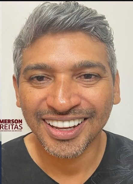 Sorriso depois do tratamento
