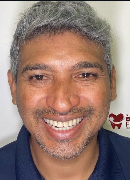 Sorriso antes do tratamento